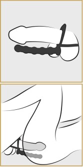 Penisring met Anaal Dildo 05334670 3